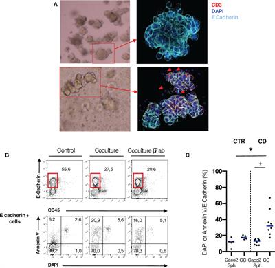 Autologous organoid co-culture model reveals T cell-driven epithelial cell death in Crohn’s Disease